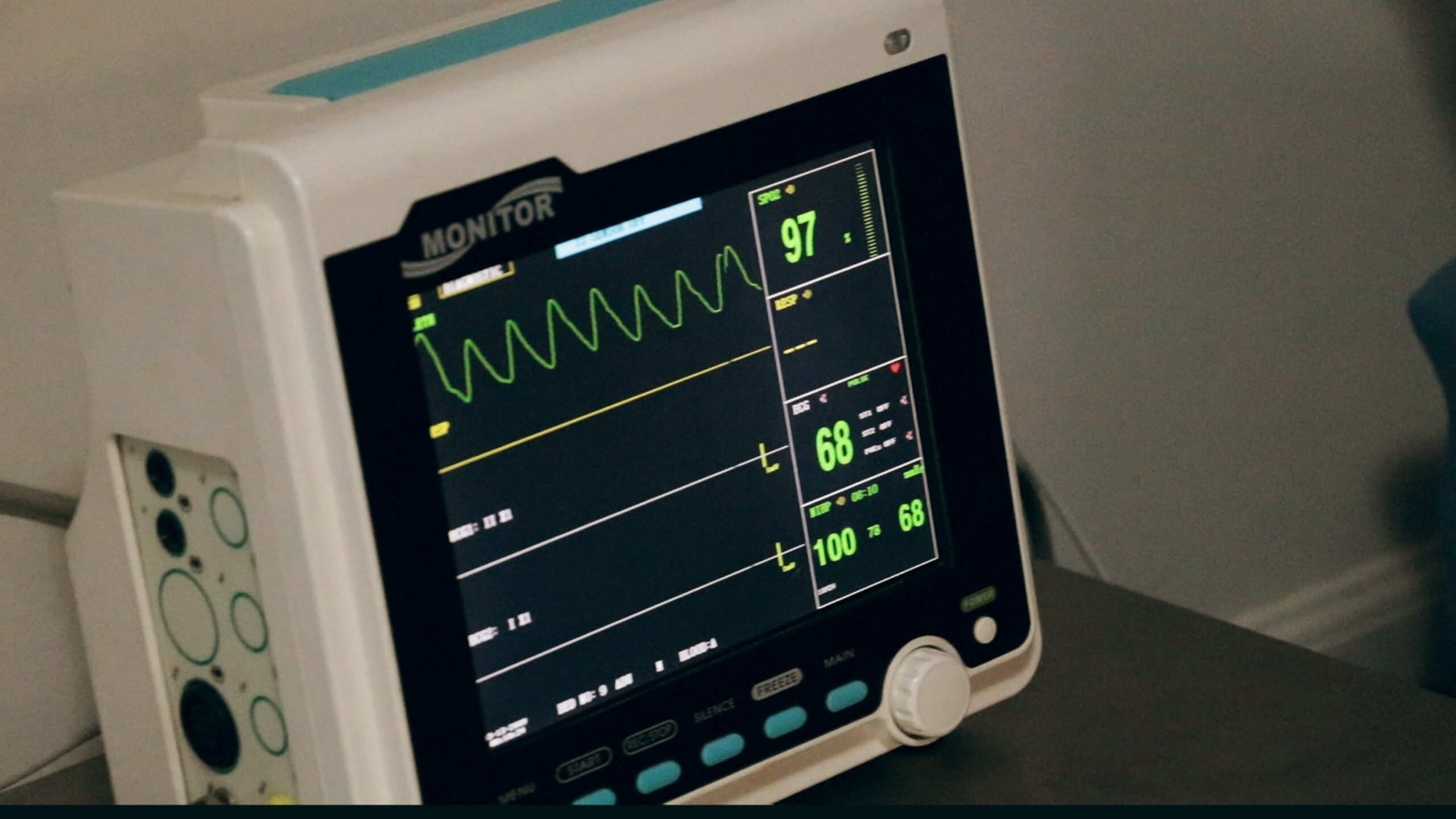 A picture of Electrocardiogram